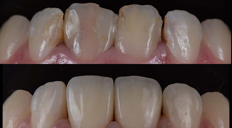 Treatment Banner thumb : Welling Dental