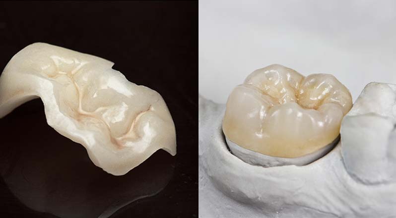 Treatment Banner thumb : Welling Dental