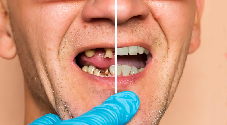 Treatment Banner thumb : Welling Dental