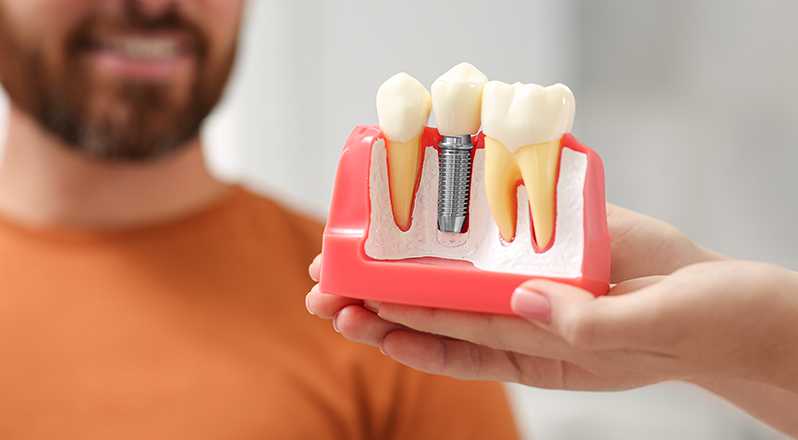 singletooth-img-inner Treatment Banner thumb : Welling Dental