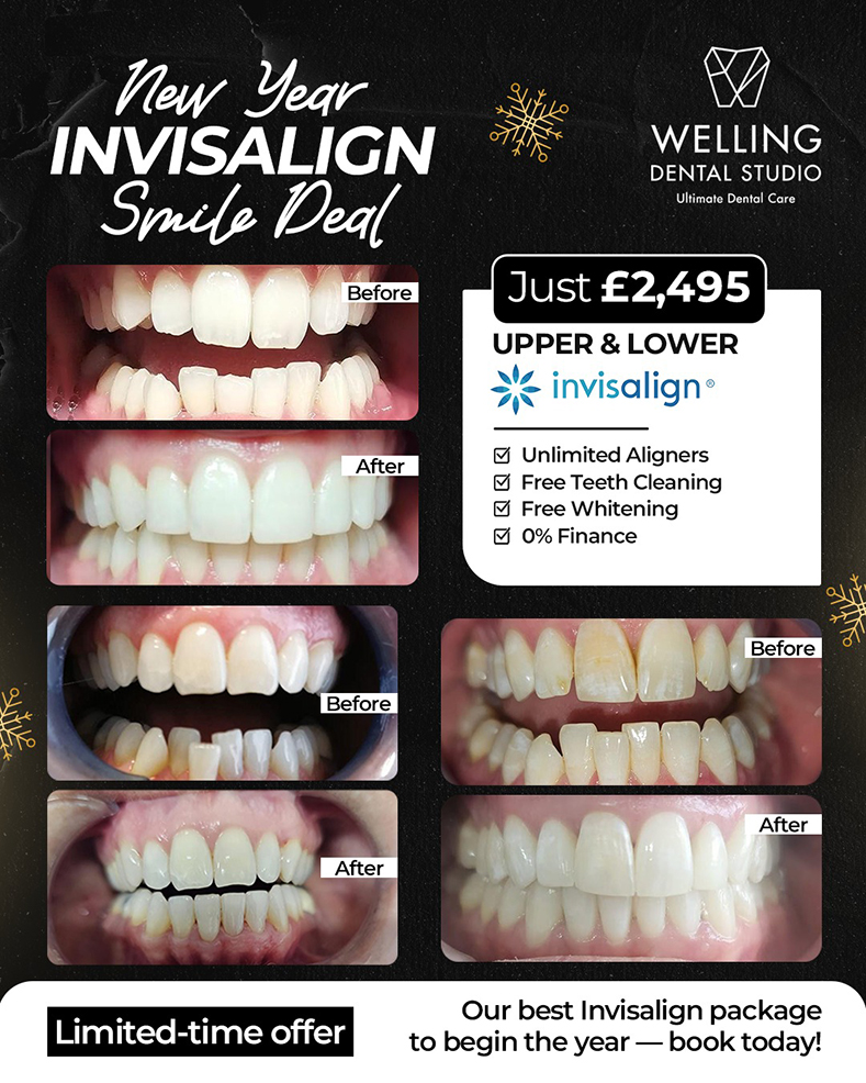 New Year Invisalign Smile Deal