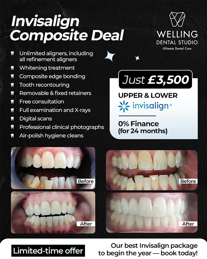 all-inclusive-package-block-new