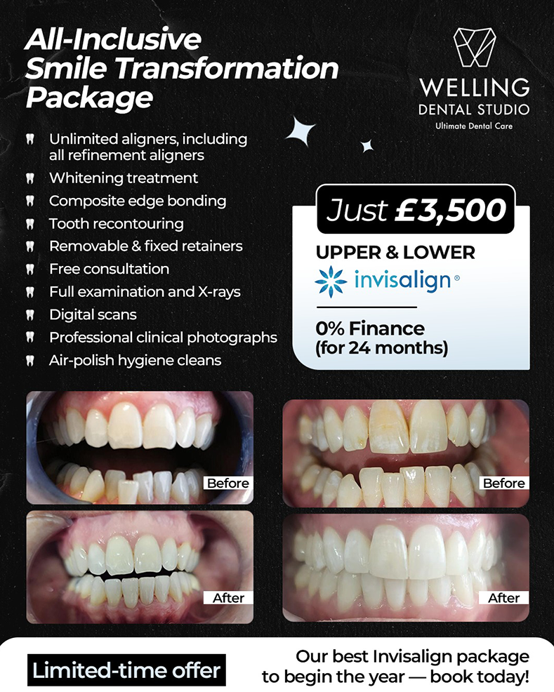All Inclusive Smile Trasformation package