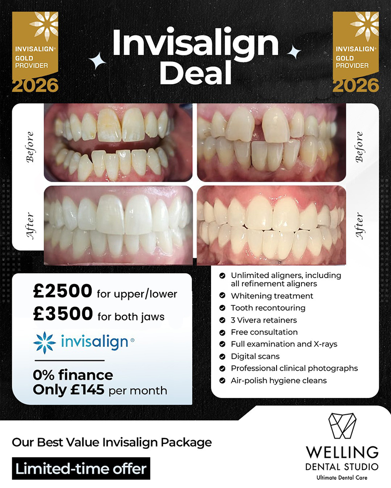 Invisalign Composite