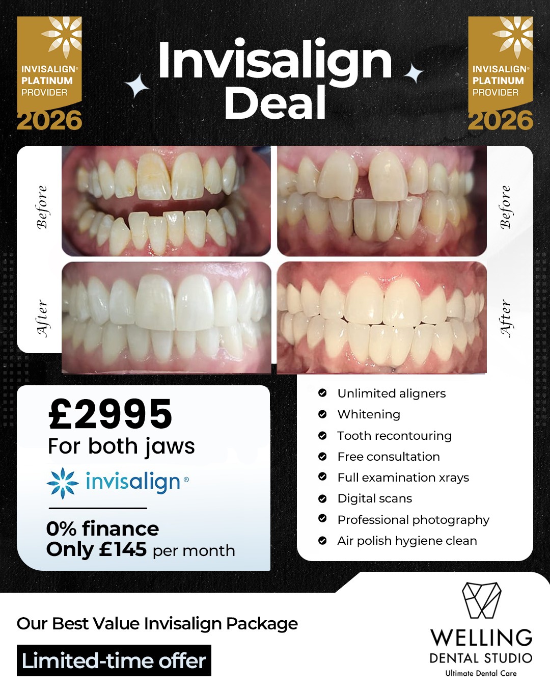 Invisalign Deal