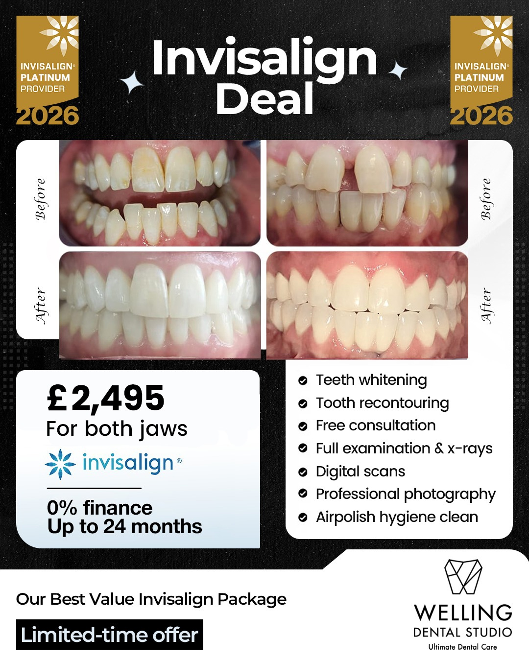 Invisalign Deal